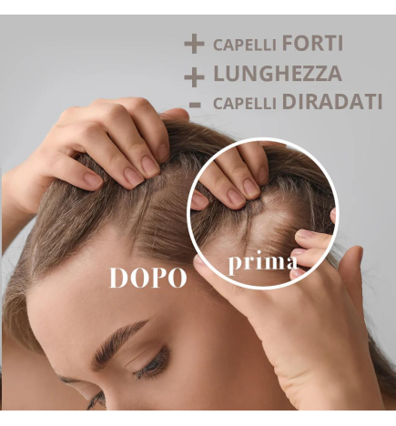 Lozione stimolante capelli tendenti a caduta 100 ml - MaterNatura